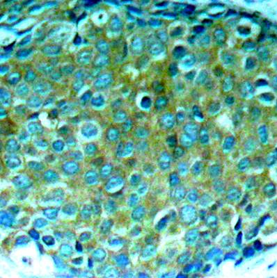 PAK1 (Ab-212) Antibody