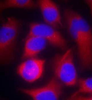 PAK1 (Ab-212) Antibody