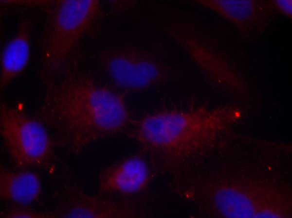 PAK1/PAK2/PAK3 (Phospho-Thr423/Thr402/Thr421) Antibody