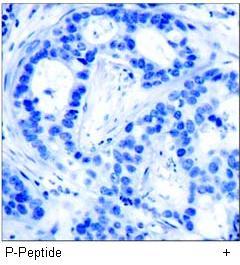 PAK1 (Phospho-Thr212) Antibody