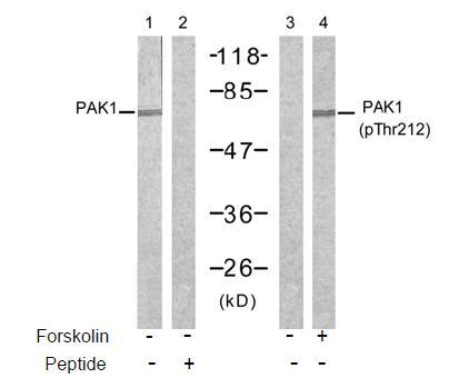 PAK1 (Phospho-Thr212) Antibody