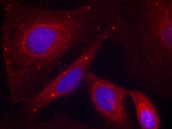 PAK1 (Phospho-Thr212) Antibody