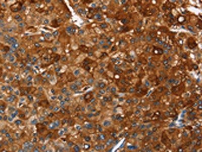 PAK2 Antibody