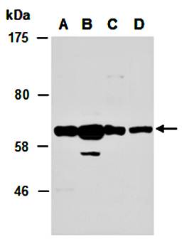 PAK2 (N2) Antibody, Rabbit Polyclonal