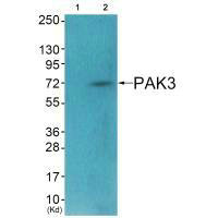 PAK3 (Ab-154) Antibody