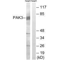 PAK3 (Ab-154) Antibody
