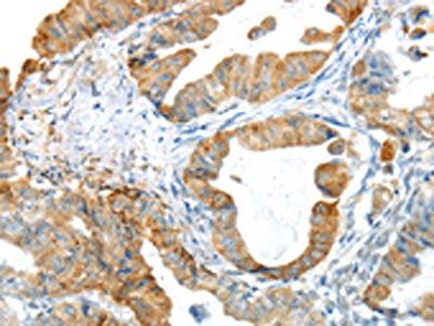 PAK3 Antibody