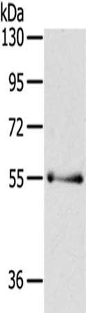 PAK3 antibody