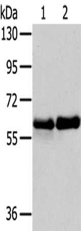 PAK3 Antibody