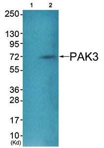 PAK3 (Ab-154) Antibody