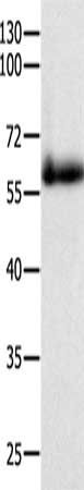 PAK4 antibody