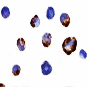 PAK5 Antibody