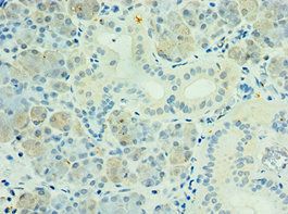 PAK6 Antibody
