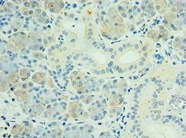 PAK6 antibody