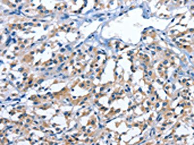 PAK6 Antibody