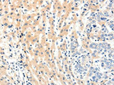 PAK7 Antibody
