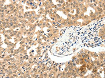 PAK7 Antibody