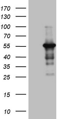 PALB2 Antibody