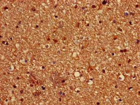 PALM Antibody