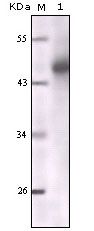 Cytokeratin (Pan) Antibody