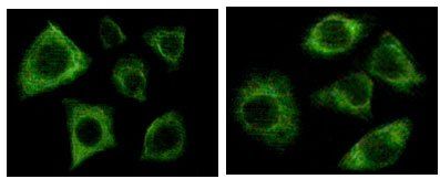 Cytokeratin (Pan) Antibody