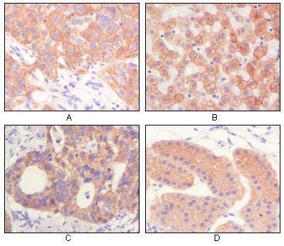 Cytokeratin (Pan) Antibody