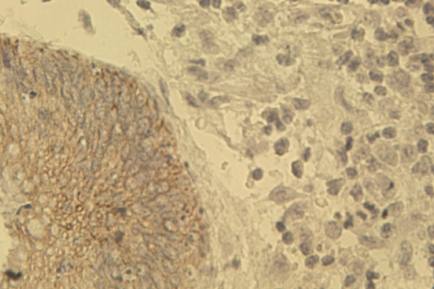 Mouse Human Keratin (4,5,6,8,10,13,18) Antibody