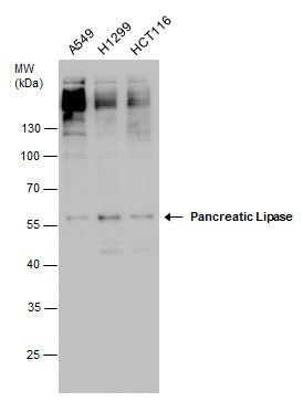 Pancreatic Lipase antibody