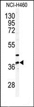 PANK3 antibody
