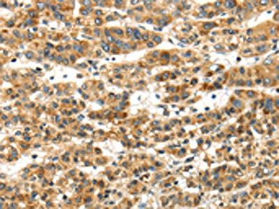 PAPPA Antibody