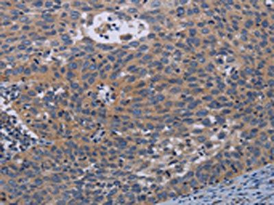 PAPPA Antibody