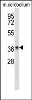 PAQR8 antibody