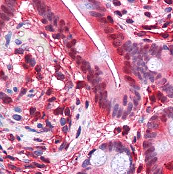 PAR4 Antibody