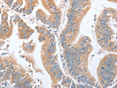 PARD6A Antibody