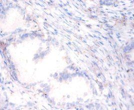 paraoxonase/arylesterase 1 antibody