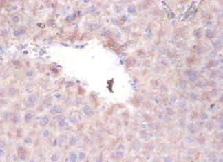 PON1 Antibody