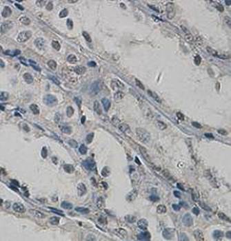 Parathymosin Rabbit Polyclonal Antibody