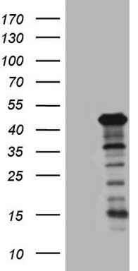 PTH Antibody