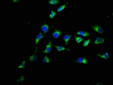 PARD3 Antibody