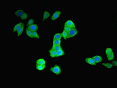 PRKN Antibody