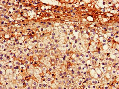 PRKN Antibody