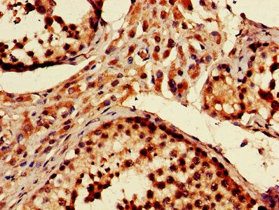 PRKN Antibody
