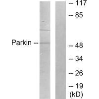 PARK2 antibody
