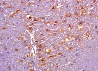 Phospho-PARK2 (Ser101) Rabbit Polyclonal Antibody