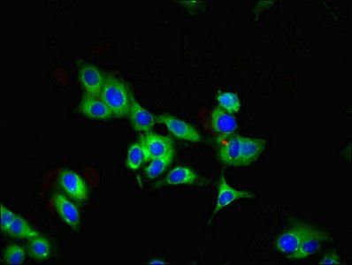 PARK7 Antibody