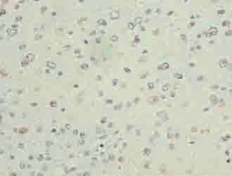 PARK7 Antibody