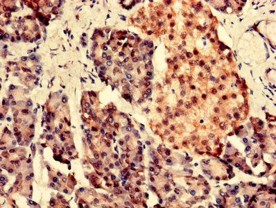PARK7 Antibody