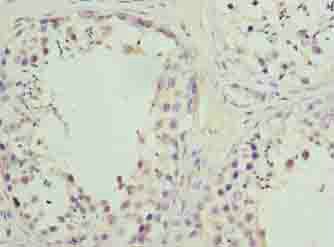PARK7 Antibody