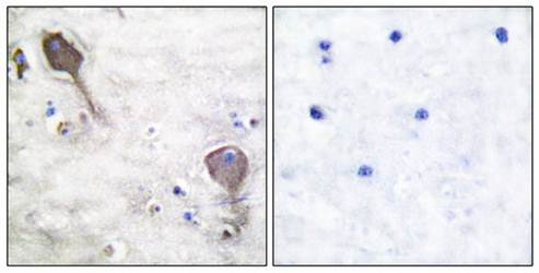Parkin Antibody