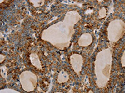 PARL Antibody